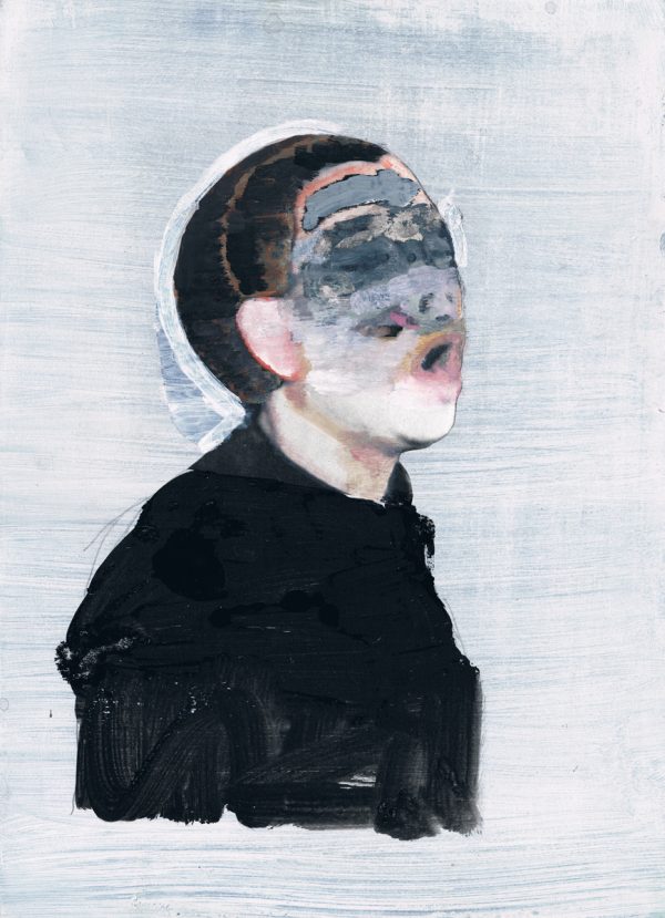 Impacted Elements no.15
